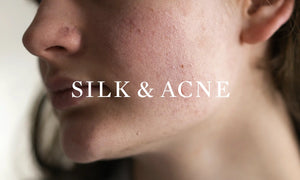 OPSUNDBAY Silk and Acne