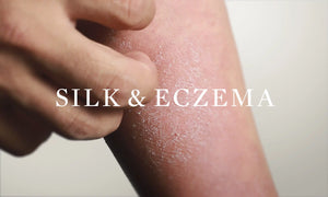 OPSUNDBAY silk and eczema